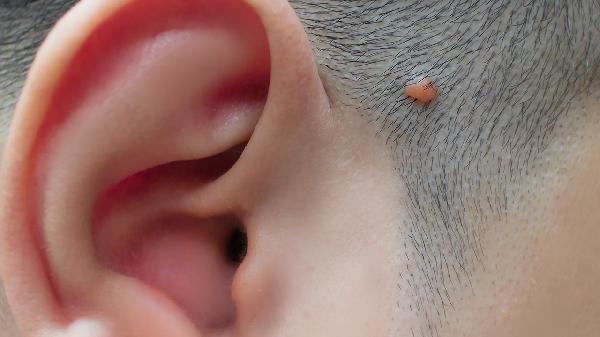 o4YBAGkv3-GAYQsSAABrBea653g569-1 o4YBAGkv3-GAYQsSAABrBea653g569-1