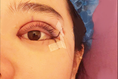 o4YBAGkv3zSAOgRmAAERRk1MNX8465