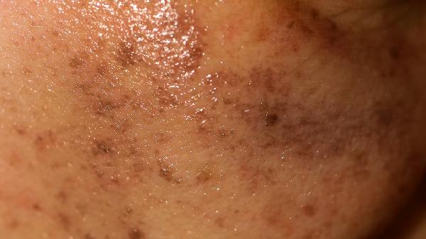 o4YBAGkv4CuAUlrdAAByfS-RY6s950-1 o4YBAGkv4CuAUlrdAAByfS-RY6s950-1