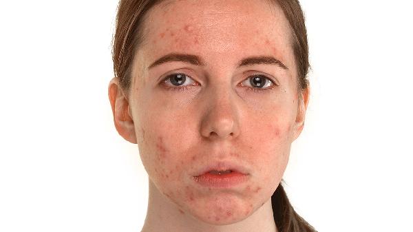 o4YBAGkv4H6AbOeYAABIGzVRlo8855 o4YBAGkv4H6AbOeYAABIGzVRlo8855