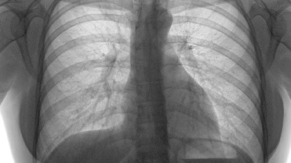 oYYBAGkv36aAJWbrAABaha4R7zM292-1