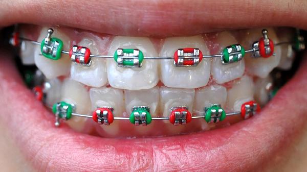 oYYBAGkv3ueAAl-1AAB_a5lBCMo816-1