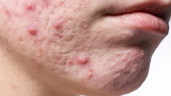 oYYBAGkv4FiAMB8PAACFOdiN-5k148