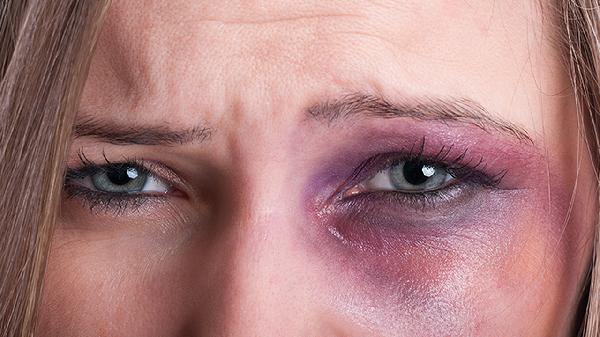 oYYBAGkv4USAeniGAACZq3VJ_40652