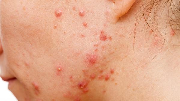 oYYBAGkv4VeAQi_BAABpM3Z38UI989-1