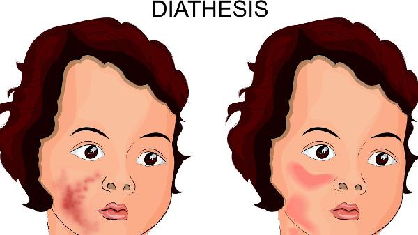 oYYBAGkv4YaAX0rWAABuXDqtNMc291