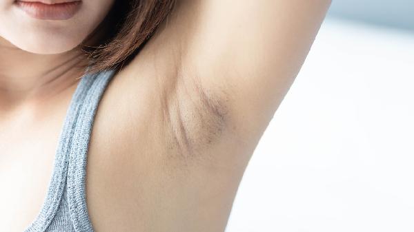 ooYBAGkv31OAbKUcAABGXkJx55w129