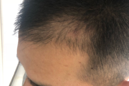 ooYBAGkv35yABHxfAADgk5A-GCA725