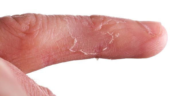 ooYBAGkv4D-ABBpeAABQNt0Wtvo486 ooYBAGkv4D-ABBpeAABQNt0Wtvo486