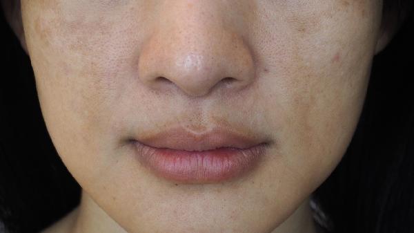 ooYBAGkv4GCAMMzgAABJ_2mRwHI587-1 ooYBAGkv4GCAMMzgAABJ_2mRwHI587-1