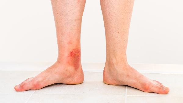 ooYBAGkv4TOAD-dBAABBnAVvSWA245-1