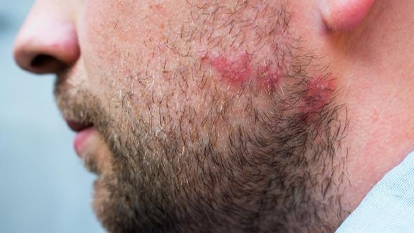 ooYBAGkv4XqAchizAACLZD4-iL0432