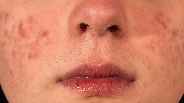 ooYBAGkv4YmAa_wPAABi69htHnE672